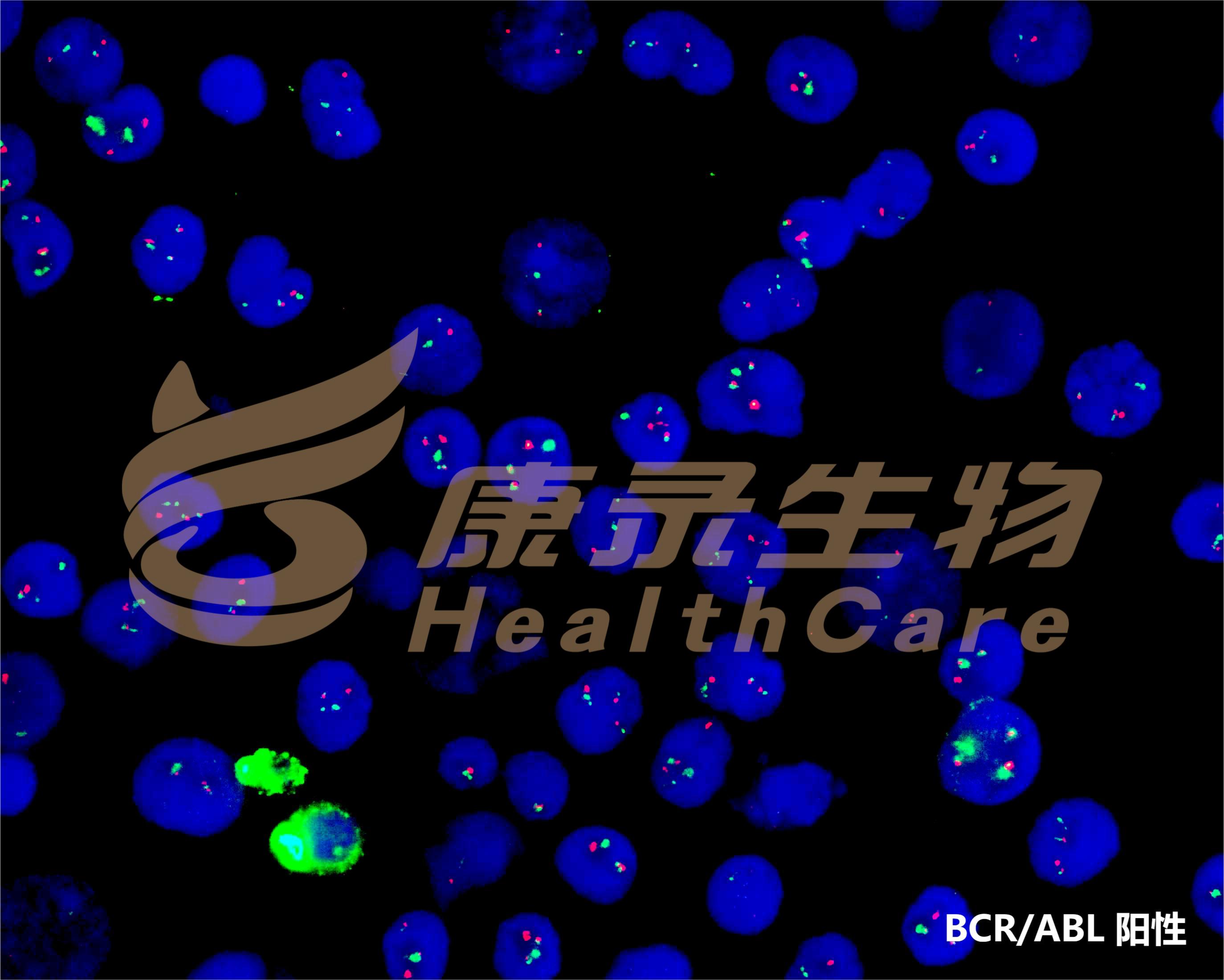 BCR/ABL融合基因检测试剂盒（荧光原位杂交法）-武汉康录生物技术股份有限公司